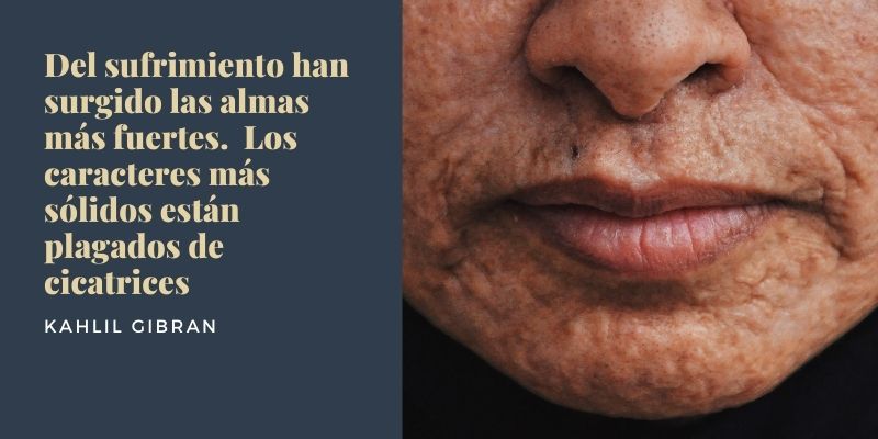 Qué es la resiliencia